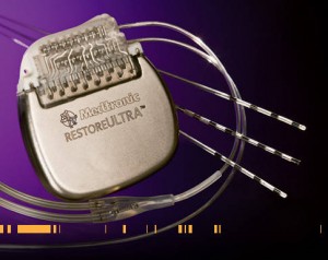 The CPU/Battery/Stim Unit